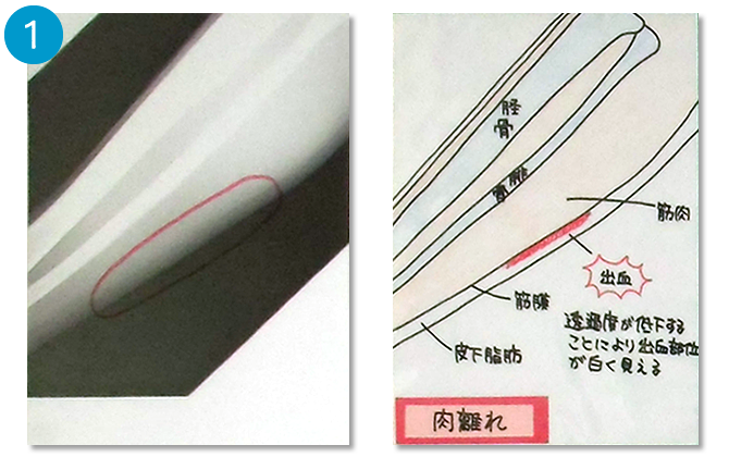 健康通信 Vol 13 大道整形外科 整形外科 リハビリテーション科 リウマチ科