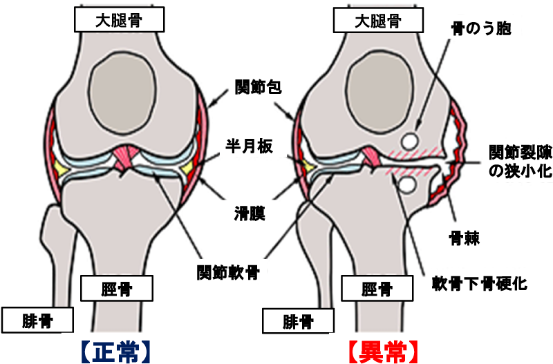 健康通信 Vol 30 大道整形外科 整形外科 リハビリテーション科 リウマチ科